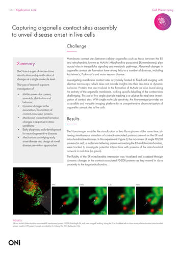 Capturing organelle contact sites assembly to unveil disease onset in live cells