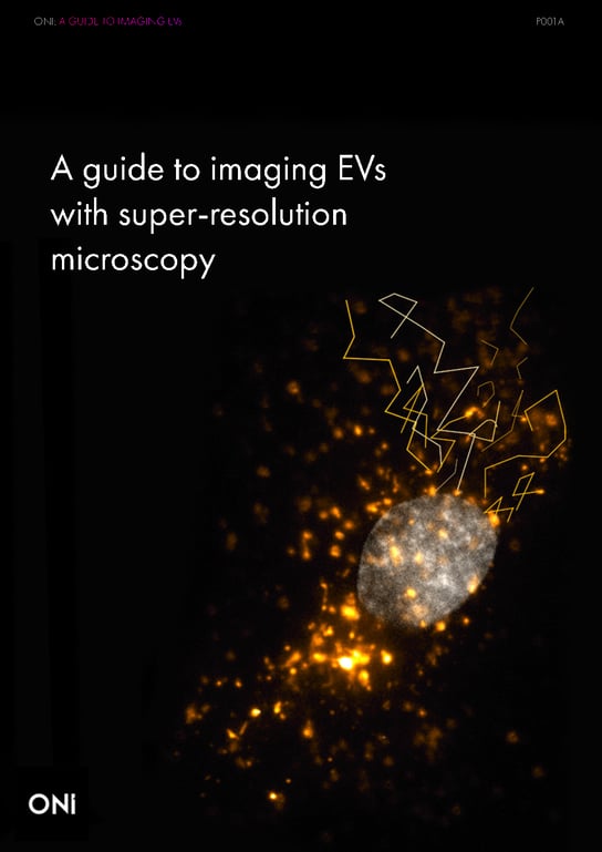EV_super-resolution_guide EV_super-resolution_guide